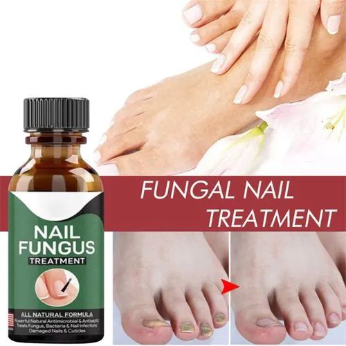 Nail Fungal Repair Serum | Nail Fungus Removal Gel